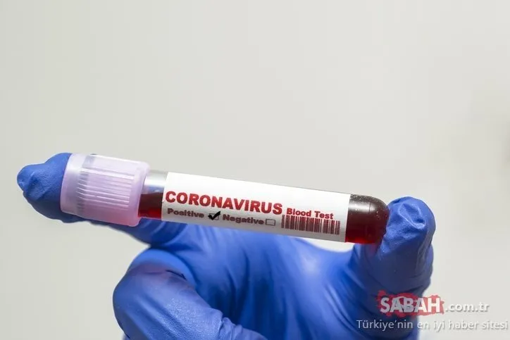 Corona virüsü belirtileri kaç gün sürer? Korona virüs belirtileri nasıl anlaşılır?