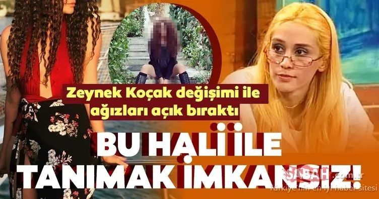 Estetikle değişen Zeynep Koçak Bu sen olamazsın dedirtti! Oğuzhan Koç ile evliliğin eşiğinden dönmüştü...