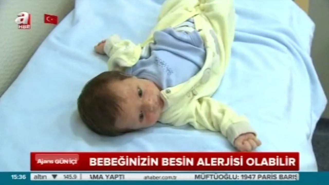 Bebeklerde alerji belirtileri nelerdir? Bebeklerde alerjiye sebep olan gıdalar nasıl tespit edilir?