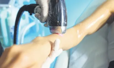 Lazer epilasyon dehşeti