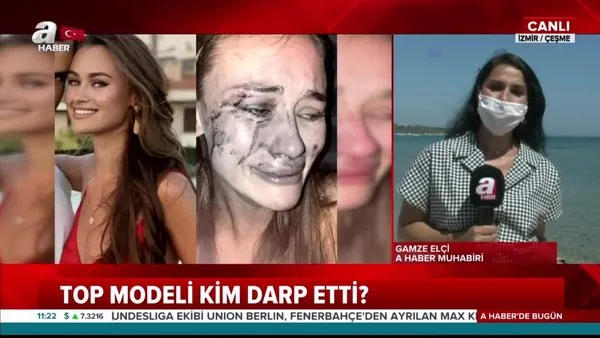 Son Dakika Haberi: İzmir Çeşme’de darp edildiğini iddia eden ünlü Top Model Daria Kyryliuk olayında kafa karıştıran detay | Video