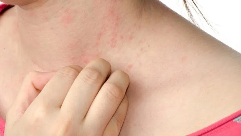 egzamaya ne iyi gelir egzama nedir