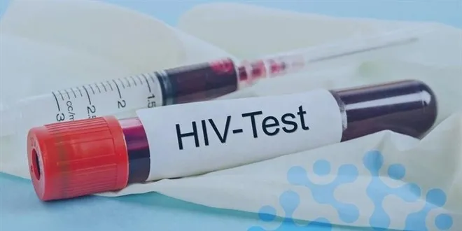 AIDS nedeniyle hayatını kaybeden 13 yaşındaki çocukta cinsel istismar bulgusu var mı? İzmir İl Sağlık Müdürlüğü açıkladı