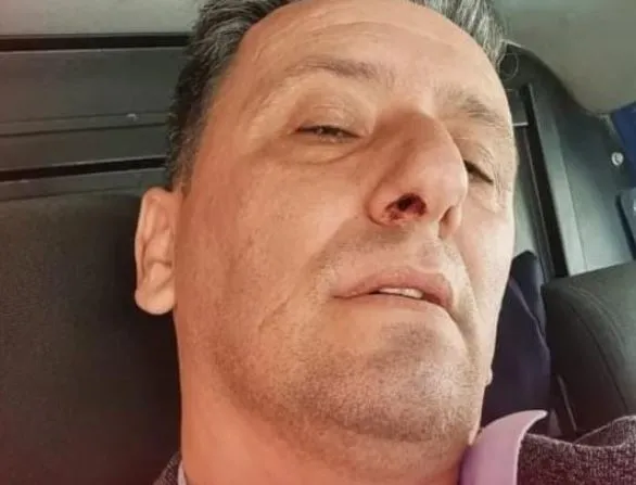 Memleket Partili Özgür Türker'e darp: 'Oy' hesabı yapan saldırgan yolunu kesti! - Son Dakika Haberler