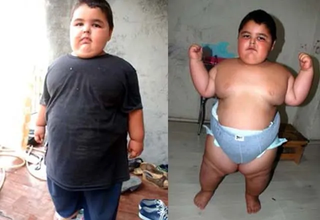 6 yaşındaki ağabeyi 42 kilo 4,5 yaşındaki Murat Can ise…