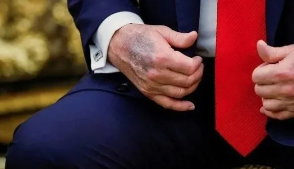 son-dakika-abd-baskani-donald-trumpin-saglik-durumu-nasil-doktoru-acikladi-olaganustu-derecede-1760169475075.jpg SON DAKİKA… ABD Başkanı Donald Trump’ın sağlık durumu nasıl? Doktoru açıkladı: Olağanüstü derecede…