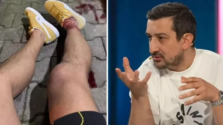 Serhat Akın’a saldırı ile ilgili flaş gelişme: 2 kişi gözaltına alındı! İşte o saldırganlar...