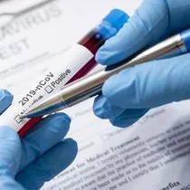 Corona Testi Kac Gunde Cikar Korona Testi Kac Gunde Belli Olur E Nabiz Ile Pcr Test Sonucu Sorgulama Sabah
