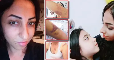 SON DAKİKA HABERİ | Eski kocası Saime’nin hayatını kabusa çevirdi: Korkudan sokağa bile çıkamıyor! Ölmek istemiyorum