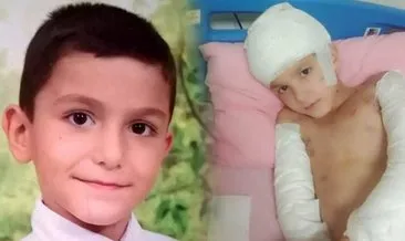 Tunahan Yılmaz sokak köpeklerinin saldırısı ile ölümden dönmüştü: İşte iki belediye yetkilisi hakkında istenen ceza! #ankara