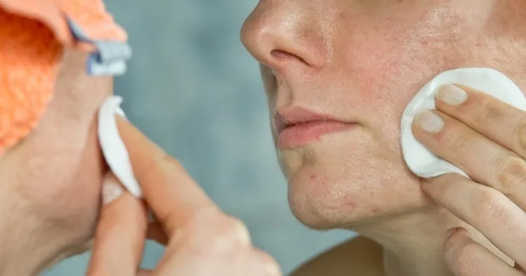 Sivilce çukurlarından kurtulmanın yolu!