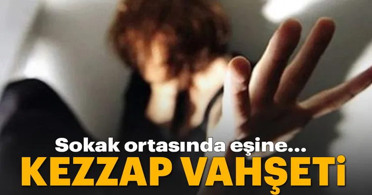 Sokak ortasında eşine kezzap atıp kaçtı