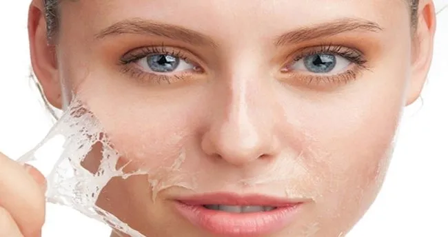 ciltte leke neden olur saglik haberleri