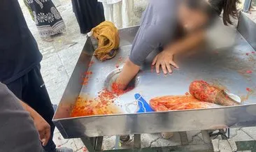 Şanlıurfa'da talihsiz olay: 16 yaşındaki kız elini makineye kaptırdı! #sanliurfa