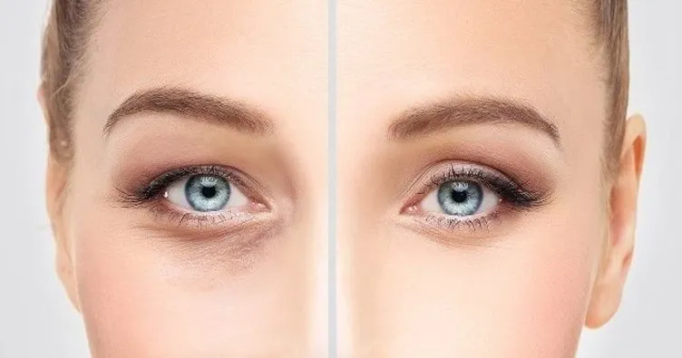 Göz çevresi nasıl daha genç görünür? Göz çevresinin genç göstermenin püf noktaları
