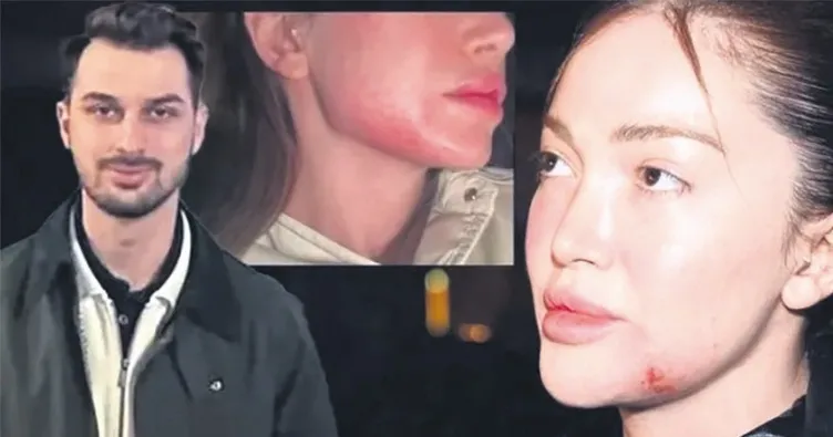 Dayakçı sevgili ile uzlaşmadı