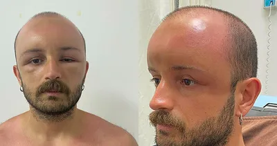 Denizden çıkan adam aynaya bakınca şoke oldu! Daha önce böyle bir vakayla karşılaşmadık!