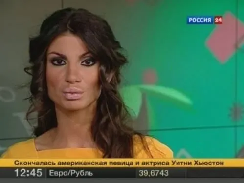 Rusya’da yeni moda Angelina dudağı