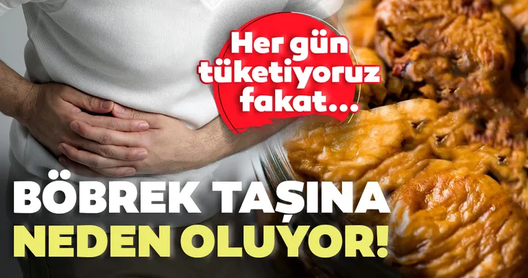 Bu yiyeceklere dikkat! Böbrek taşına neden oluyor