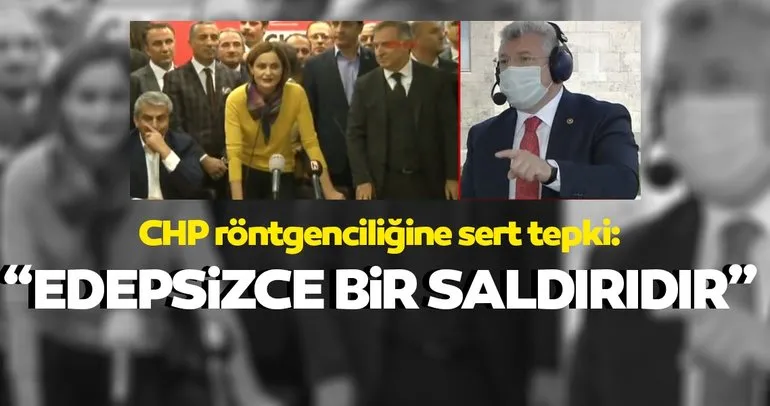 AK Parti’den CHP röntgenciliğine tepki: Bu edepsizce bir saldırıdır!
