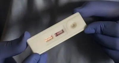 HIV pozitif olduğunu eşinden sakladı: Hakkında kasten öldürmeye teşebbüs suçundan 20 yıla kadar hapis istemiyle dava açıldı