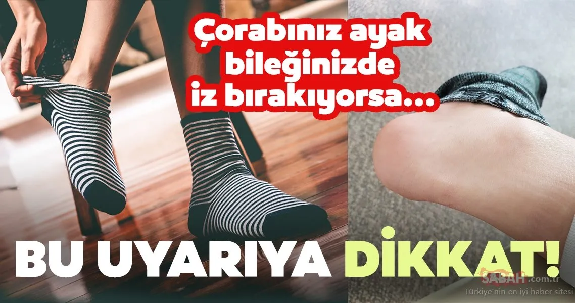 Kalbinizin düzgün çalışmadığını gösteren 8 sinyale dikkat! Galeri