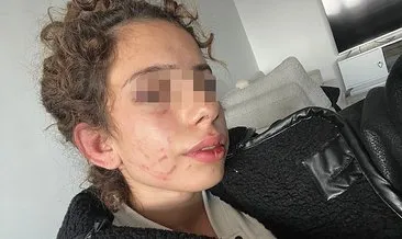 Dayakçı sevgiliye 19 yıl hapis talebi #konya
