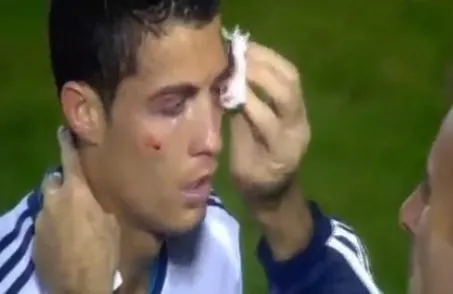 Ronaldo kanlar içinde kaldı