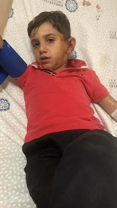 İzmir’de başıboş köpek dehşeti: 6 yaşındaki Baran ölümden döndü!