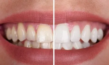 Bu besin sayesinde dişleriniz anında beyazlayacak! İşte dişlerinizi beyazlatmanın doğal yolu...