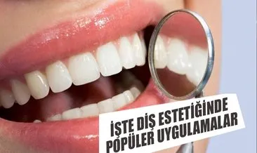 Dis Estetiginde Populer Uygulamalar Dis Hekimi Ilker Erdogan