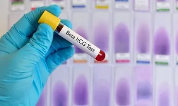 5 haftalık gebelikte beta HCG kaç olmalı? Beta HCG kanda gebelik testinde kaçıncı haftada yükselir?