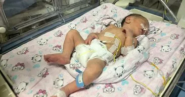 Trafik kazasında ölmüştü! Annesinin karnındaki bebek böyle kurtarıldı! Mucize gibi yaşam savaşı...