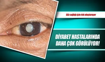 Goz Sagligi Icin Risk Olusturuyor Saglik Haberleri