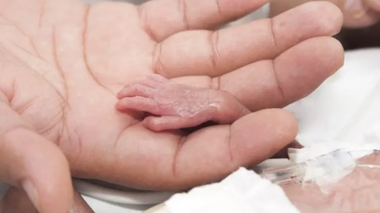 Son dakika haberi: Mucize bebek 500 gramdan daha zayıf doğdu! Yaşamaz dediler ama…