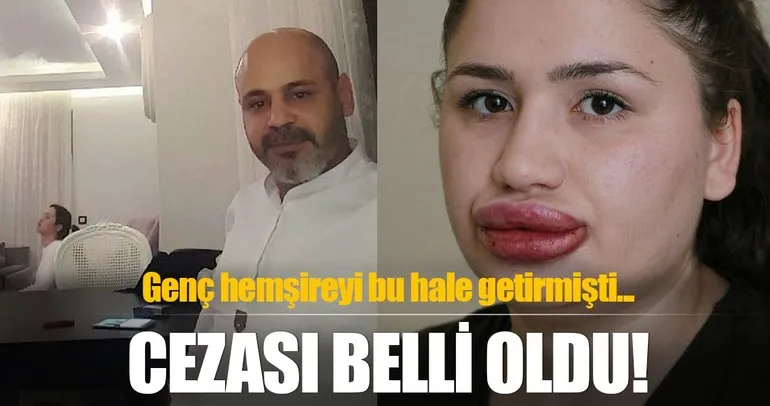 yuz nakli olduktan sonra taninan recep sert tutuklandi sayfa 3 son dakika haberler