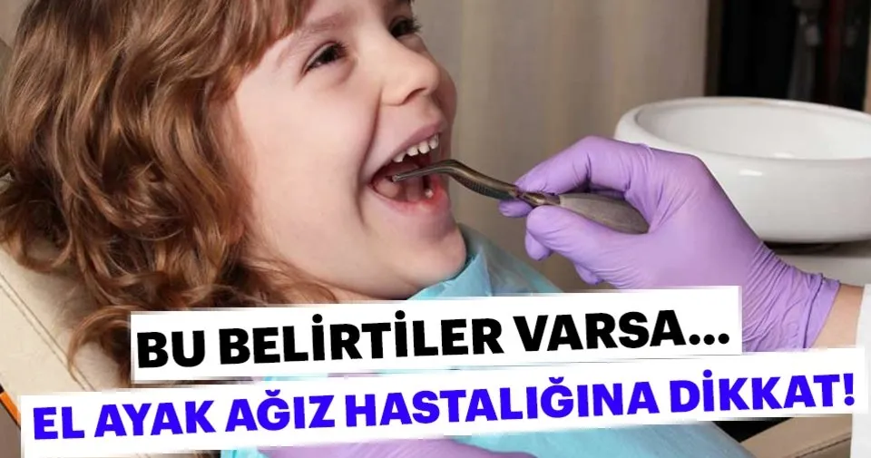 El Ayak Agiz Hastaligina Dikkat Saglik Haberleri