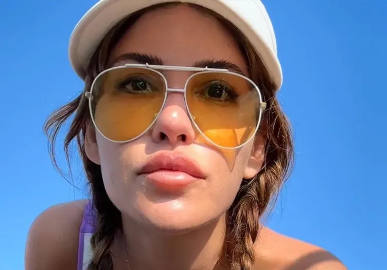 Türkan Şoray’ın kızı Yağmur Ünal botokstan konuşamadı! Son hali görenleri şoka uğrattı