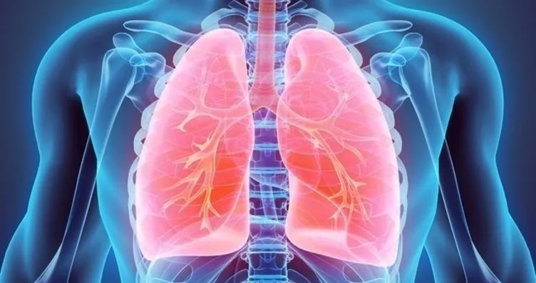 Akciğer Kanseri belirtileri nelerdir? Akciğer...