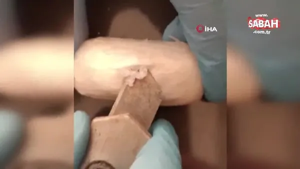 İran uyruklu şahsın bağırsağında 12 kapsül metamfetamin maddesi ele geçirildi | Video