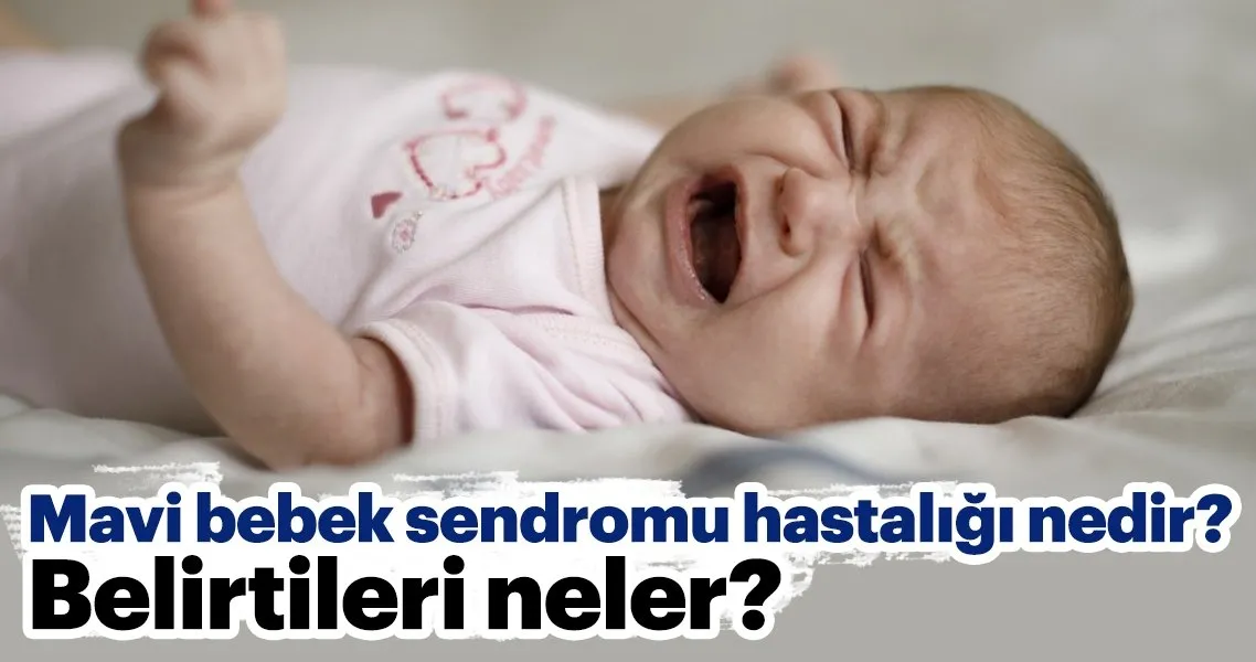 mavi bebek sendromu belirtileri nelerdir mavi bebek sendromu hastaligi nedir bebek haberleri