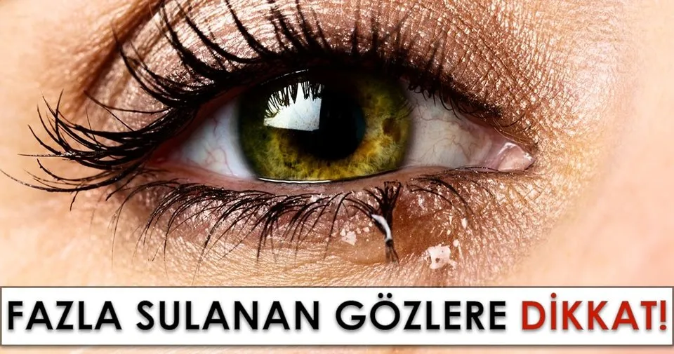 Fazla Sulanan Gozlere Dikkat Son Dakika Haberler