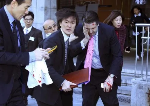 ABD’nin Seul Büyükelçisi’ne usturalı saldırı