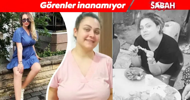 Son dakika haberi: Genç kadın evden çıkamaz haldeydi! İşte Gizem’in yaşadığı inanılmaz değişim...
