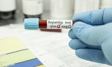 Gizemli hepatit virüsü ile ilgili DSÖ’den endişelendiren açıklama: Küresel bir salgın mı?
