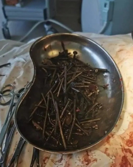 Kilolarca ve tam 10 cm! “Hayatımızda böyle bir şeyle hiç karşılaşmadık”