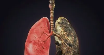 Nikotini dışarı atan süper yiyecek! 1 haftada ciğerleri tertemiz yapıyor...