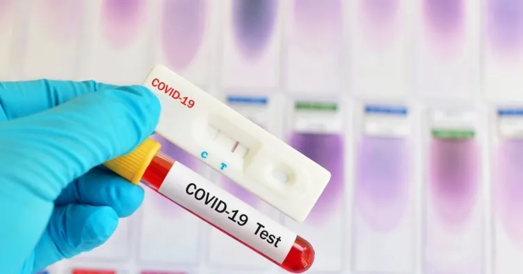 Korona testi kaç günde, saatte belli olur? Covid 19 PCR testi kaç günde çıkar?