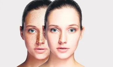 Cilt lekelerine kış bakımı