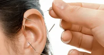Akupunktur tedavisinde yeni trend!